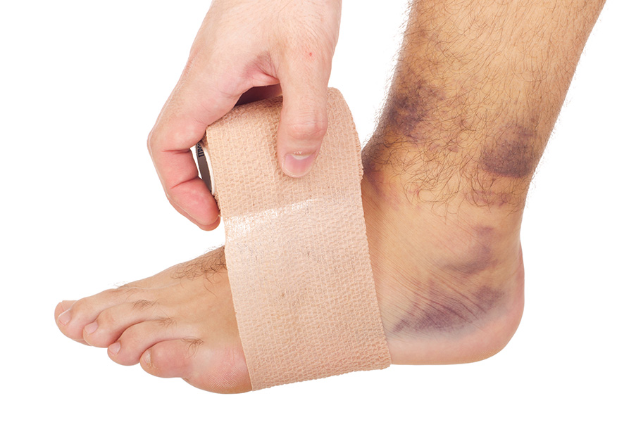 esguince tobillo hematoma grado 2 fisioterapia Fidoos Vallecas Madrid