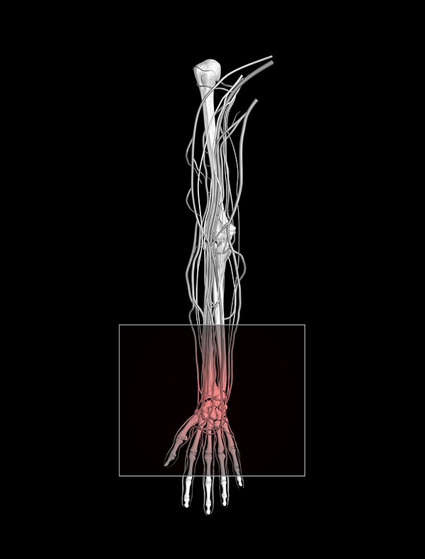 túnel carpiano anatomía nervio mediano fisioterapia Madrid túnel carpiano anatomía nervio mediano fisioterapia Madrid