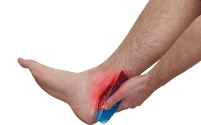 Tendinitis en runners de verano: por qué el calor y el asfalto te machacan el Aquiles