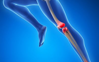 Dolor al correr en cadera, rodilla y tobillo: causas y solución en una sola clínica
