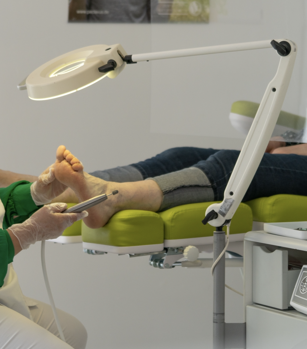Tratamiento de uñero en Clínica Fidoos Vallecas Podóloga tratando uña encarnada en clínica - Fidoos Vallecas